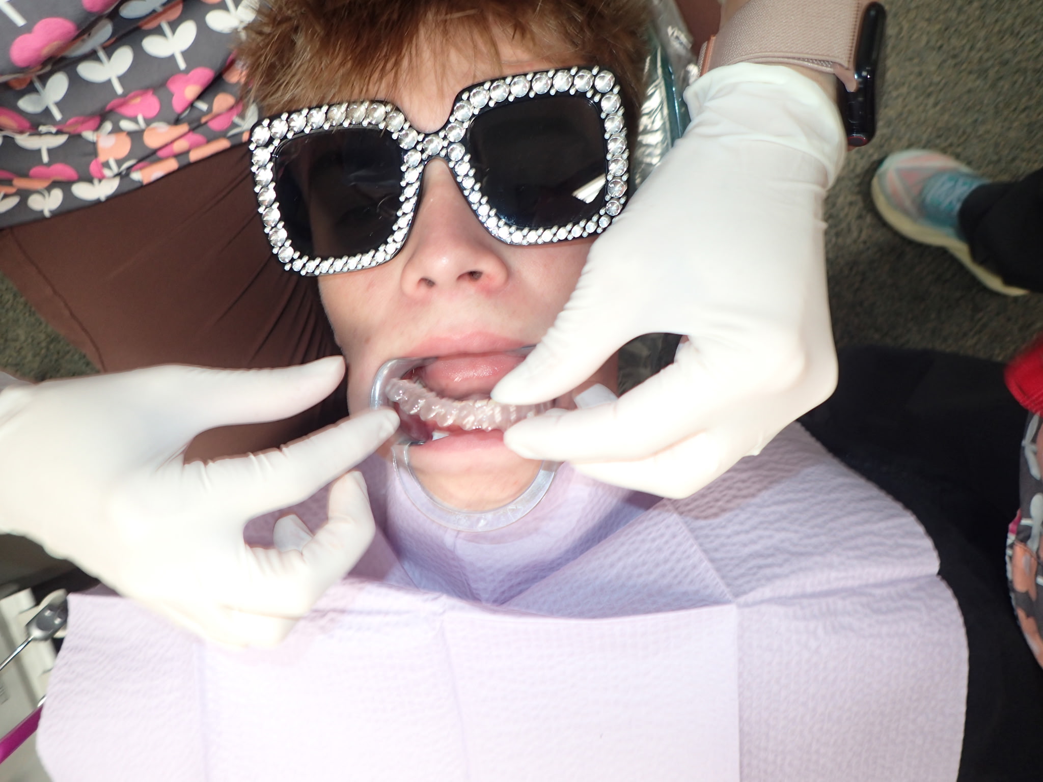Invisalign service